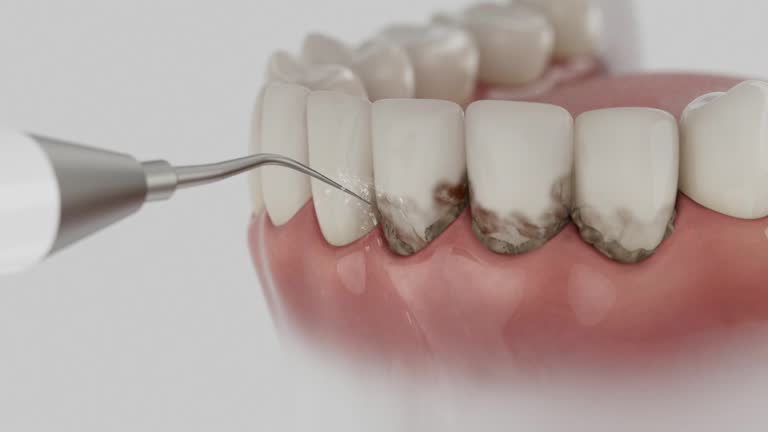 Reliable Wisdom Tooth Removal contractor in Jeff Davis County County, GA by Dentist Open Now